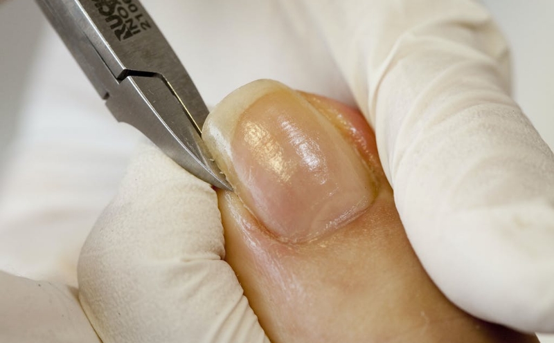 爪ケア